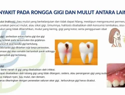 Apa penyebab bau mulut yang tidak hilang setelah sikat gigi