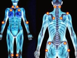 Apa penyebab fibromyalgia nyeri seluruh tubuh