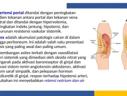 Kenapa asites perut berisi cairan terjadi pada penderita sirosis