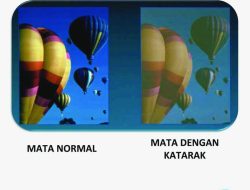 Kenapa Pandangan Kabur saat Sore Hari? Ini Penyebab dan Cara Mengatasinya