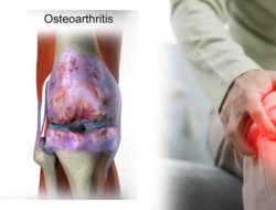 Pengaruh Cuaca Terhadap Sendi: Mengapa Cuaca Dingin dan Hujan Memperburuk Gejala Osteoarthritis?
