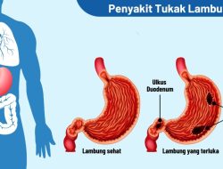 PENTING: CATATAN PENOLAKAN (DISCLAIMER)
